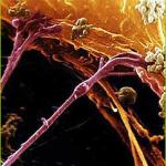 Axon