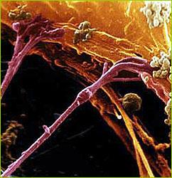 Axon